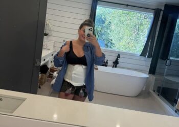 EXCLUSIVE: Brittany Cartwright Reveals She Had To Be ‘Lifted Up the Stairs’ of Her L.A. Home After Extreme ‘Mommy Makeover’ Surgery